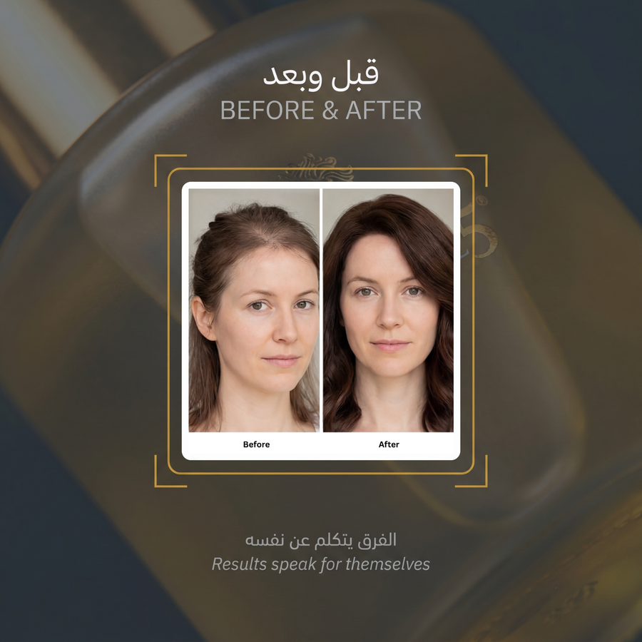 مجموعة تكثيف وتنشيط الشعر - image 6