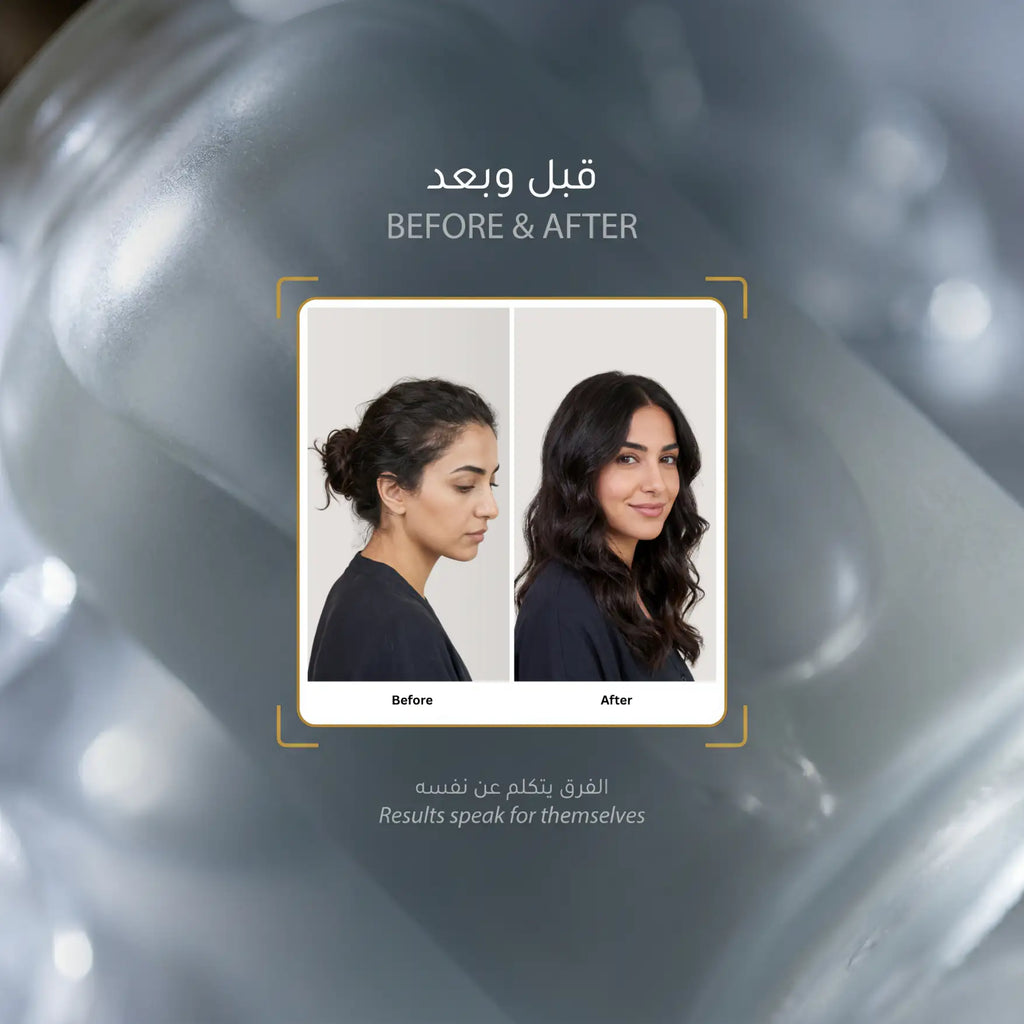 لومينيال 5 زيت الشعر بالمكونات التسعة
